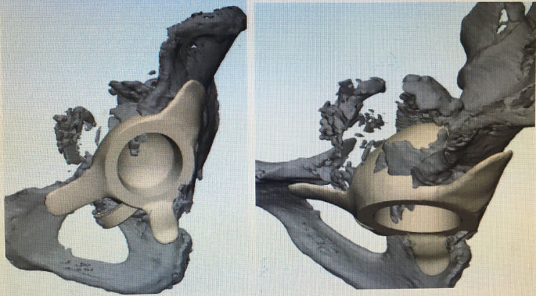 3Dӡ҂ˣĳԺǿɹ3DӡPQyʾ޴ȱpķg
