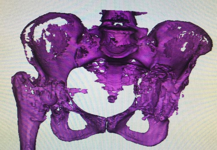 3Dӡ҂ˣĳԺǿɹ3DӡPQyʾ޴ȱpķg